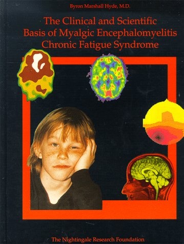 nightingale syndrome