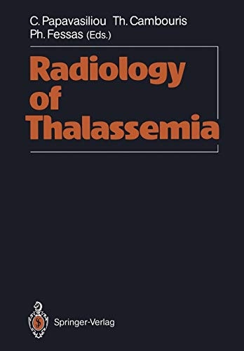 Radiology of Thalassemia
