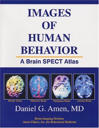 Images of Human Behavior: A Brain SPECT Atlas