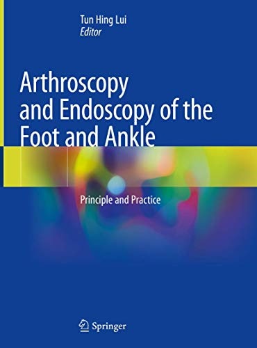 Arthroscopy and Endoscopy of the Foot and Ankle: Principle and Practice