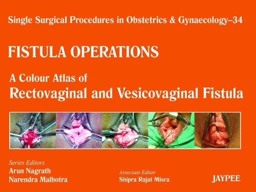 Fistula Operations: A Colour Atlas of Rectovaginal and Vesicovaginal Fistula (Single Surgical Procedures in Obstetrics and Gynaecology)