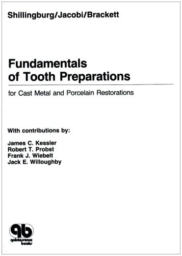 Fundamentals of Tooth Preparations for Cast Metal and Porcelain Restorations