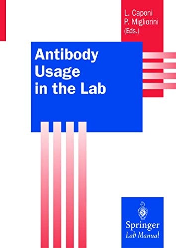 Antibody Usage in the Lab (Springer Lab Manuals)