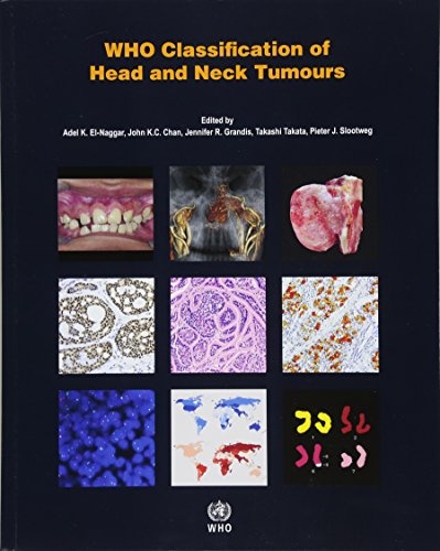WHO Classification of Head and Neck Tumours (WHO Classification of Tumours)