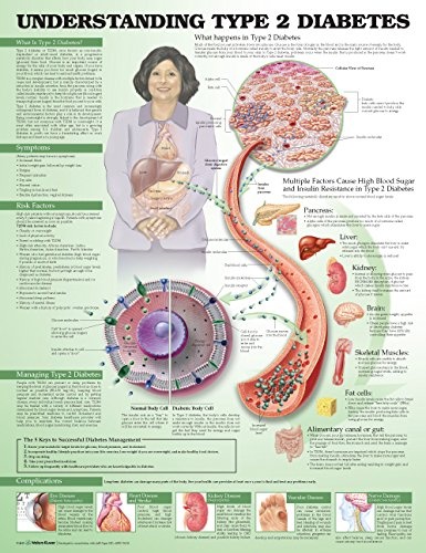 Understanding Type 2 Diabetes Anatomical Chart