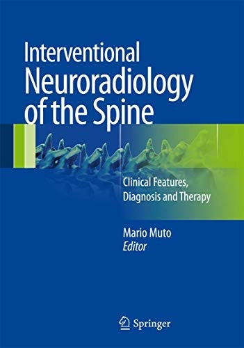 Interventional Neuroradiology of the Spine: Clinical Features ...