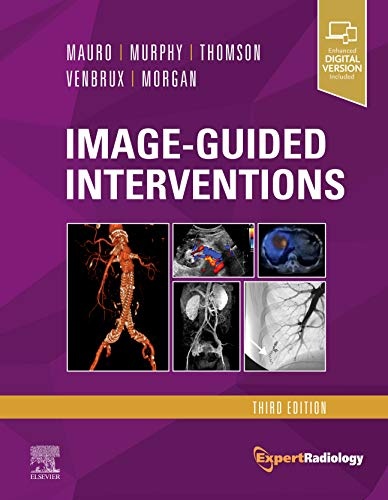 Image-Guided Interventions: Expert Radiology Series, 3e