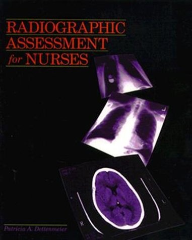 Radiographic Assessment For Nurses
