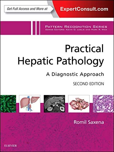 Practical Hepatic Pathology: A Diagnostic Approach: A Volume in the Pattern Recognition Series