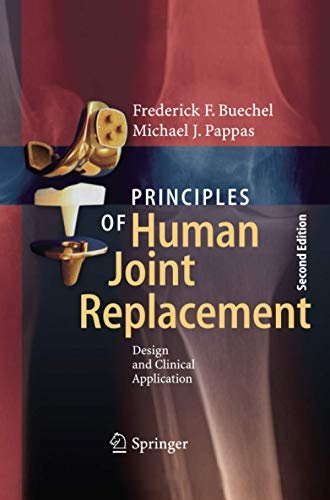Principles of Human Joint Replacement: Design and Clinical Application