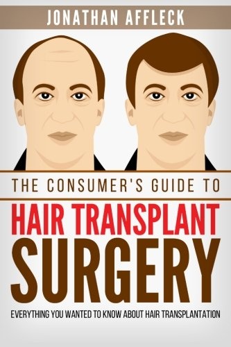 The Consumer's Guide to Hair Transplant Surgery: Everything You Wanted to Know About Hair Transplantation