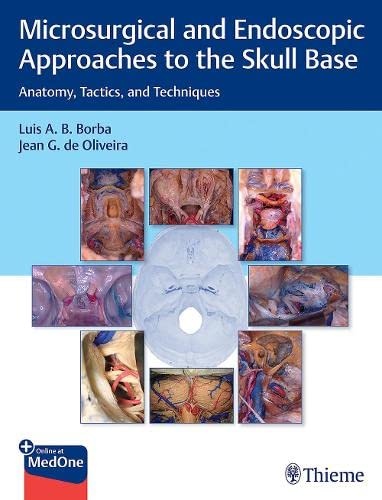 Microsurgical and Endoscopic Approaches to the Skull Base: Anatomy, Tactics, and Techniques