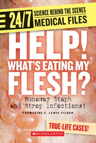 Help! What's Eating My Flesh?: Runaway Staph and Strep Infections! (24/7: Science Behind the Scenes: Medical Files)