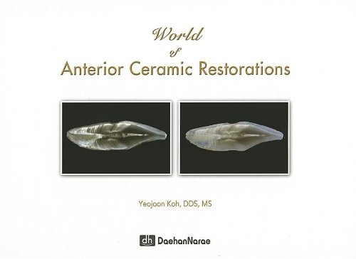 World of Anterior Ceramic Restorations