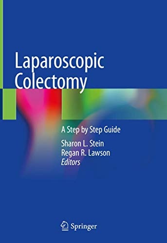 Laparoscopic Colectomy: A Step by Step Guide