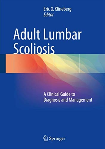 Adult Lumbar Scoliosis: A Clinical Guide to Diagnosis and Management